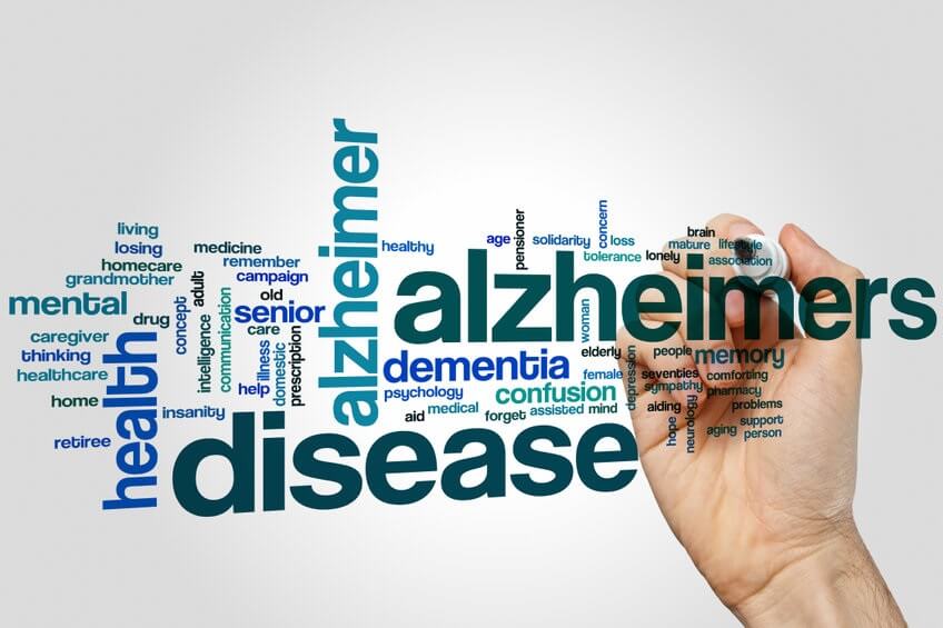 Alzheimers Guide