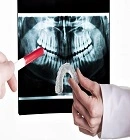 Grinding Your Teeth