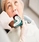 Dentures (false teeth)