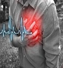 Heart Attack