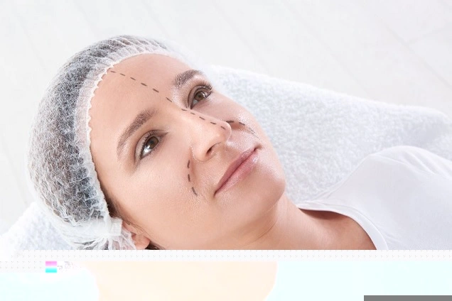 Nose reshaping rhinoplasty cosmetic surgery